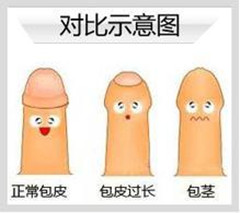 阳江包皮过长是否造成男性不育