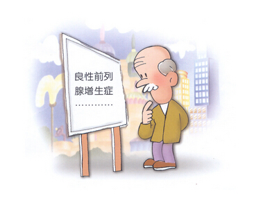 前列腺增生